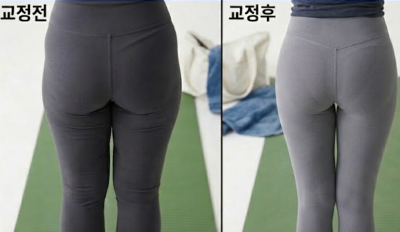 골반 전방경사